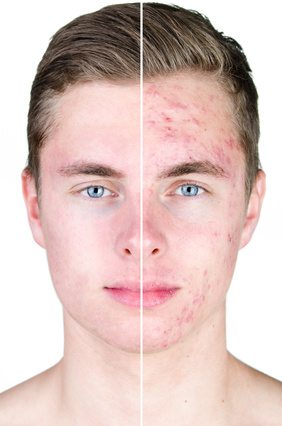 whip Cooperative consultant Laser frakcyjny na blizny - depilacja laserowa - dermatolog prywatnie - medycyna estetyczna - botox - Elbląg whip Cooperative consultant Laser frakcyjny na blizny - depilacja laserowa - dermatolog prywatnie - medycyna estetyczna - botox - Elbląg